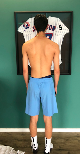 Why Assessing Resting Posture Matters For Pitchers